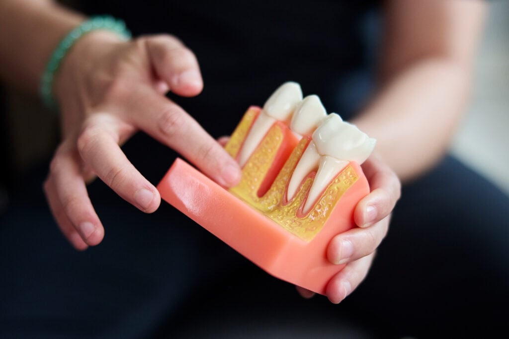 A hand points to a tooth on an anatomical jaw model to illustrate dental anatomy.